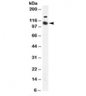 Western blot testing of K562 cell lysate with CD57 antibody (clone HNK-1). Predicted molecular weight: ~38/110 kDa (unmodified/glycosylated).
