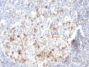 IHC analysis of formalin-fixed, paraffin-embedded human tonsil stained with CD57 antibody (clone HNK-1).