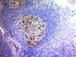 IHC: Formalin-fixed, paraffin-embedded human tonsil stained with CD57 antibody (clone NK/804).