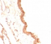 IHC: Formalin-fixed, paraffin-embedded rat lung stained with Glypican-3 antibody (GPC3/863)