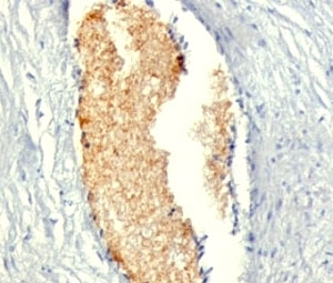 IHC: Formalin-fixed, paraffin-embedded human placenta stained with AMPD3 antibody (AMPD3/901)~