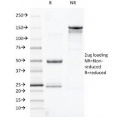 SDS-PAGE analysis of purified, BSA-free TOX3 antibody (clone TOX3/1123) as confirmation of integrity and purity.