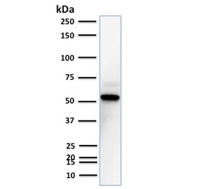 Western blot testing of human A431 cell lysate with TOX3 antibody. Predicted molecular weight ~63 kDa.~