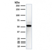 Western blot testing of human A431 cell lysate with TOX3 antibody. Predicted molecular weight ~63 kDa.