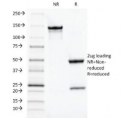 SDS-PAGE Analysis of Purified, BSA-Free TOX-3 Antibody (clone TOX3/1124). Confirmation of Integrity and Purity of the Antibody.