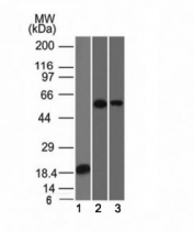 Western blot analysis of 1) recombinant partial protein, 2) A549 and 3) A431 stained with TOX-3 antibody (clone TOX3/1124). Predicted molecular weight ~63 kDa.