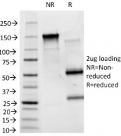 SDS-PAGE Analysis of Purified, BSA-Free ABO Antibody (clone HEB-20). Confirmation of Integrity and Purity of the Antibody.