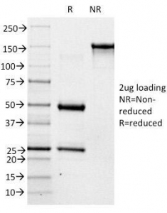 SDS-PAGE Analysis of Purified, BSA-Free ABO Antibody (clone 3-3A). Confirmation of Integrity and Purity of the Antibody.