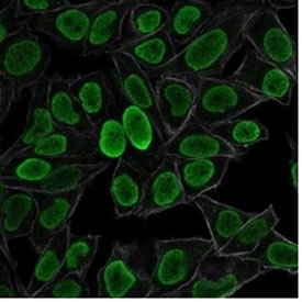 Immunofluorescent staining of PFA-fixed human HeLa cells with Histone antibody (green, clone AE-4) and phalloidin (red).