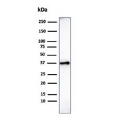 Western blot testing of human heart tissue lysate with Histone antibody (clone AE-4). Observed molecular weight ~22/30-33 kDa (unmodified/modified).