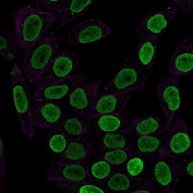 Immunofluorescent staining of permeabilized human HeLa cells with anti-Histone H1 antibody (clone SPM256, green) and Phalloidin (red).