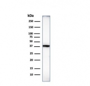 Western blot testing of human heart lysate with Histone antibody (clone 1415-1). Observed molecular weight ~22/30-33kDa (unmodified/modified).