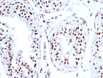IHC: FFPE human testicular carcinoma tested with Histone H1 antibody (clone HH1/957).