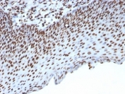 IHC: Formalin-fixed, paraffin-embedded human tonsil stained with Histone H1 antibody (clone HH1/957).