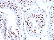 IHC: FFPE human testicular carcinoma tested with Histone H1 antibody (clone HH1/957).