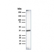 Western blot testing of human heart lysate with Histone H1 antibody. Predicted molecular weight ~20 kDa but can be observed at 27-33 kDa.