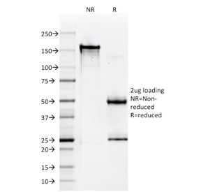 SDS-PAGE analysis of purified, BSA-free HLA-A antibody (clone 108-2C5) as confirmation of integrity and purity.