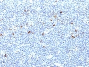 IHC: Formalin-fixed, paraffin-embedded human tonsil stained with HLA-Aw32 / HLA-A25 antibody (CATA-1).