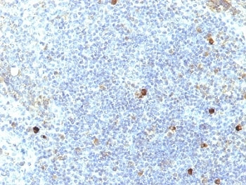 IHC: Formalin-fixed, paraffin-embedded human tonsil stained with HLA-Aw32 / HLA-A25 antibody (SPM417).