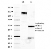 SDS-PAGE analysis of purified, BSA-free HLA-B antibody (clone JOAN-1) as confirmation of integrity and purity.