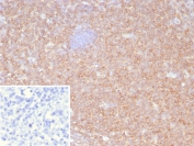 SDS-PAGE Analysis of Purified, BSA-Free HLA-B Antibody (clone JOAN-1 ). Confirmation of Integrity and Purity of the Antibody.