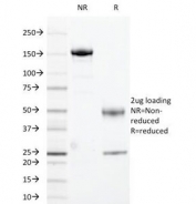 SDS-PAGE Analysis of Purified, BSA-Free HLA-DR Antibody (clone 169-1B5.2). Confirmation of Integrity and Purity of the Antibody.