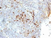 IHC: Formalin-fixed, paraffin-embedded human tonsil stained with HLA-DR antibody (clone 19-26.1 or MB-26.1).