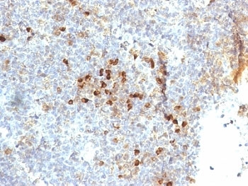 IHC: Formalin-fixed, paraffin-embedded human tonsil stained with HLA-DR antibody (19-26.1).~