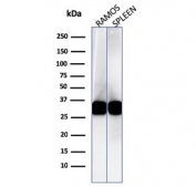 Western blot testing of human Ramos and spleen cell lysate with HLA-DRB1 antibody (clone LN3). Expected molecular weight ~30kDa.