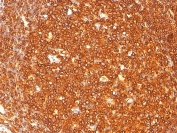 IHC staining of FFPE human tonsil with HLA-DRB1 antibody (clone SPM289). HIER: boil tissue sections in pH 9 10mM Tris with 1mM EDTA for 10-20 min and allow to cool before testing.