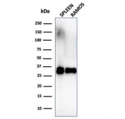 Western blot testing of human spleen and Ramos lysate with HLA-DRB1 antibody (clone SPM289). Predicted molecular weight ~30 kDa.