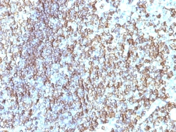 IHC: Formalin-fixed, paraffin-embedded human tonsil stained with HLA-DRB1 antibody (clone SPM288).~