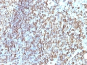 IHC: Formalin-fixed, paraffin-embedded human tonsil stained with HLA-DRB1 antibody (clone SPM288).