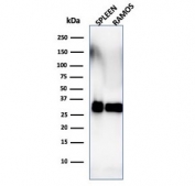 Western blot testing of human spleen and Ramos lysate with HLA-DRB1 antibody (clone SPM288). Predicted molecular weight ~30 kDa.
