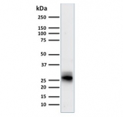 Western blot testing of human spleen lysate with anti-HLA-DRB1 antibody (clone SPM423). Predicted molecular weight ~30 kDa.