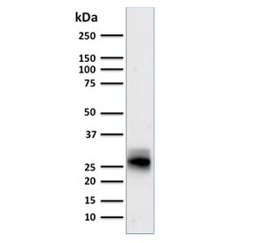 Western blot testing of human spleen lysate with anti-HLA-DRB1 antibody (clone SPM423). Predicted