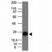 Western blot Anaysis of Ramos cell Lyste using HLA-DRB1 antibody (HLA-DRB/1067). Predicted molecular weight ~30 kDa.