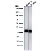 Western blot Anaysis of human 1) Ramos and 2) spleen cell Lyste using HLA-DRB1 antibody (clone HLA-DRB/1067). Predicted molecular weight ~30 kDa.
