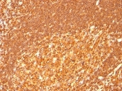 IHC: Formalin-fixed, paraffin-embedded human tonsil stained with HLA-DRB antibody (clone HLA-DRB/1067).