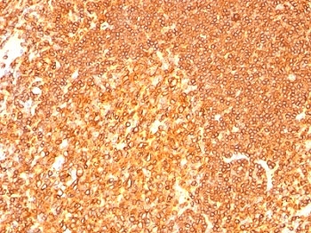 IHC: Formalin-fixed, paraffin-embedded human tonsil stained with HLA-DRB1 antibody (LN3 + HLA-DRB/1067).~