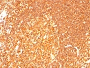IHC: Formalin-fixed, paraffin-embedded human tonsil stained with HLA-DRB1 antibody (LN3 + HLA-DRB/1067).