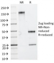SDS-PAGE analysis of purified, BSA-free HSP27 antibody (clone HSPB1/774) as confirmation of integrity and purity.