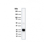 Western blot testing of human HeLa cell lysate with HSP27 antibody. Expected molecular weight: 23~27 kDa.