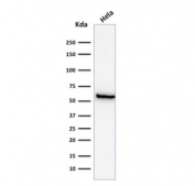 Western blot testing of human HeLa lysate with HSP60 antibody (clone GROEL/730). Predicted molecular weight: ~60 kDa.