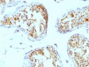 IHC: Formalin-fixed, paraffin-embedded human testicular carcinoma stained with Perlecan antibody (A7L6).