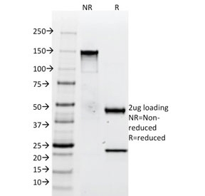SDS-PAGE analysis of purified, BSA-free anti-Tenascin C antibody (clone SPM319) as confirmation of integrity and