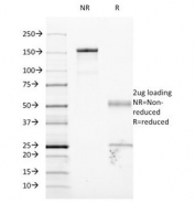 SDS-PAGE Analysis of Purified, BSA-Free ICAM-1 Antibody (clone 1H4 or W-CAM-1 or Wehi-CAM-1). Confirmation of Integrity and Purity of the Antibody.
