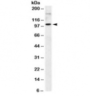 Western blot testing of human Raji cell lysate with ICAM-1 antibody (clone 1H4). Predicted molecular weight: ~58/75-115kDa (unmodified/glycosylated).