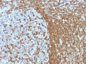 IHC: Formalin-fixed, paraffin-embedded human tonsil stained with ICAM3 antibody (ICAM3/1019)