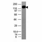 Western blot analysis of HL-60 cell lysate using ICAM3 antibody (ICAM3/1019). Observed molecular weight: 60~120 kDa depending on glycosylation level.